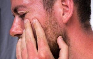 توصیه متخصص پوست برای آفتاب سوختگی در خیابان